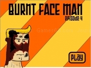 Play Burnt face man - episode 4