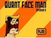 Play Burnt face man - episode 6